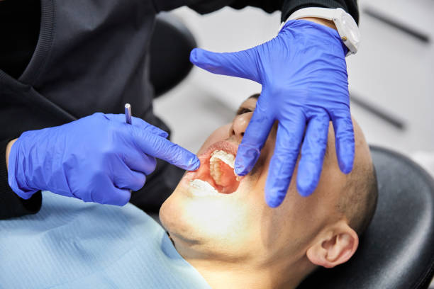 Best Emergency Dental Care for Sports Injuries in Lake Kiowa, TX