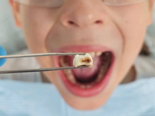 Best Emergency Orthodontic Repairs in Lake Kiowa, TX
